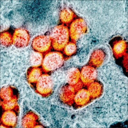 新冠肺炎病毒电子显微图像
